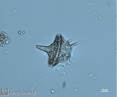 Photo of Amylax triacantha